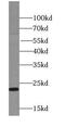 Reticulon 1 antibody, FNab07521, FineTest, Western Blot image 