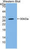Coagulation Factor III, Tissue Factor antibody, LS-C314185, Lifespan Biosciences, Western Blot image 