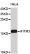 Interferon Induced Transmembrane Protein 3 antibody, STJ24128, St John