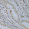 Medium-chain specific acyl-CoA dehydrogenase, mitochondrial antibody, 15-279, ProSci, Immunohistochemistry frozen image 