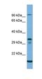 Transmembrane 6 Superfamily Member 2 antibody, orb325145, Biorbyt, Western Blot image 