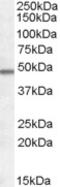 Hypocretin Receptor 1 antibody, TA303362, Origene, Western Blot image 