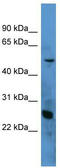 Complement C1q A Chain antibody, TA342833, Origene, Western Blot image 