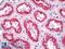 Lymphocyte Antigen 75 antibody, LS-B8619, Lifespan Biosciences, Immunohistochemistry paraffin image 