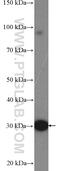 Uncoupling Protein 3 antibody, 10750-1-AP, Proteintech Group, Western Blot image 