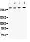 Insulin Like Growth Factor 2 Receptor antibody, PA2182, Boster Biological Technology, Western Blot image 