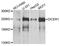 Dicer 1, Ribonuclease III antibody, A6021, ABclonal Technology, Western Blot image 