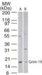 NDUFA13 antibody, NB100-56621, Novus Biologicals, Western Blot image 