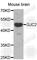 Gap Junction Protein Gamma 2 antibody, A2885, ABclonal Technology, Western Blot image 