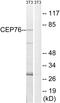 Centrosomal Protein 76 antibody, GTX87193, GeneTex, Western Blot image 
