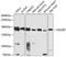 High Density Lipoprotein Binding Protein antibody, 19-982, ProSci, Western Blot image 