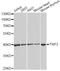 Twinfilin Actin Binding Protein 2 antibody, LS-C748680, Lifespan Biosciences, Western Blot image 