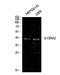 Interleukin 13 Receptor Subunit Alpha 2 antibody, A06105-1, Boster Biological Technology, Immunohistochemistry paraffin image 