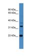 Archaelysin Family Metallopeptidase 2 antibody, orb330833, Biorbyt, Western Blot image 