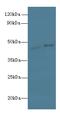 PTGES3L-AARSD1 antibody, A57926-100, Epigentek, Western Blot image 