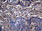 Transglutaminase 2 antibody, LS-C798664, Lifespan Biosciences, Immunohistochemistry paraffin image 