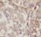 TNF Alpha Induced Protein 1 antibody, FNab08817, FineTest, Immunohistochemistry paraffin image 