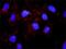 Heat Shock Protein Family B (Small) Member 1 antibody, H00003315-M04, Novus Biologicals, Proximity Ligation Assay image 