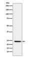 Fibronectin Type III Domain Containing 5 antibody, M02538-1, Boster Biological Technology, Western Blot image 