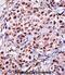 ZBTB7A antibody, abx027879, Abbexa, Immunohistochemistry frozen image 