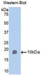 BetaKlotho antibody, LS-C373609, Lifespan Biosciences, Western Blot image 