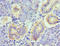 TNF Superfamily Member 13 antibody, LS-C376921, Lifespan Biosciences, Immunohistochemistry paraffin image 