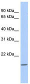 C-Type Lectin Like 1 antibody, TA337806, Origene, Western Blot image 