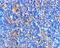 BCL2 Associated Agonist Of Cell Death antibody, A03520, Boster Biological Technology, Immunohistochemistry paraffin image 