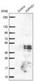 Aspartate Beta-Hydroxylase Domain Containing 1 antibody, NBP1-91686, Novus Biologicals, Western Blot image 