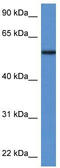 Phosphoglucomutase 5 antibody, TA343132, Origene, Western Blot image 