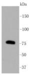 Protein Kinase C Beta antibody, NBP2-67516, Novus Biologicals, Western Blot image 