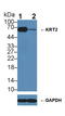 Keratin 2 antibody, LS-C295003, Lifespan Biosciences, Western Blot image 