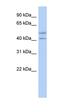 Actin Like 7B antibody, orb330719, Biorbyt, Western Blot image 