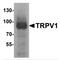 Transient Receptor Potential Cation Channel Subfamily V Member 1 antibody, MBS153345, MyBioSource, Western Blot image 