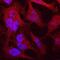 Dipeptidyl Peptidase 9 antibody, MAB5419, R&D Systems, Immunocytochemistry image 