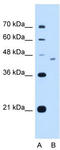 Adenosine monophosphate-protein transferase FICD antibody, TA341881, Origene, Western Blot image 