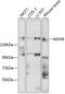 MutS Homolog 6 antibody, GTX65844, GeneTex, Western Blot image 