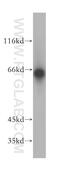 Leucine Rich Repeat LGI Family Member 2 antibody, 18044-1-AP, Proteintech Group, Western Blot image 