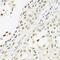 RNA Transcription, Translation And Transport Factor antibody, LS-C332568, Lifespan Biosciences, Immunohistochemistry paraffin image 