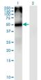 Cholinergic Receptor Nicotinic Alpha 5 Subunit antibody, H00001138-M01, Novus Biologicals, Western Blot image 