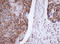 Mitochondrial Translational Initiation Factor 3 antibody, LS-C788787, Lifespan Biosciences, Immunohistochemistry paraffin image 