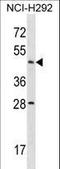 Actin Like 7B antibody, LS-C156002, Lifespan Biosciences, Western Blot image 