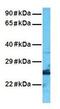 RNA Binding Motif Protein 38 antibody, GTX47297, GeneTex, Western Blot image 