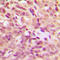 Heat Shock Protein Family B (Small) Member 1 antibody, LS-C352353, Lifespan Biosciences, Immunohistochemistry paraffin image 