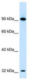 SRY-Box 30 antibody, TA330206, Origene, Western Blot image 