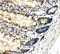 Nuclear Factor Kappa B Subunit 2 antibody, PA1946, Boster Biological Technology, Immunohistochemistry paraffin image 