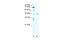 LIM Domain Binding 1 antibody, 28-732, ProSci, Enzyme Linked Immunosorbent Assay image 