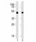 Vasodilator Stimulated Phosphoprotein antibody, F43424-0.4ML, NSJ Bioreagents, Immunohistochemistry paraffin image 