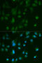 Arrestin Beta 1 antibody, 13-363, ProSci, Immunofluorescence image 