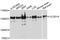 Coiled-Coil And C2 Domain Containing 1A antibody, A4800, ABclonal Technology, Western Blot image 